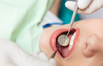 デンタルミラー