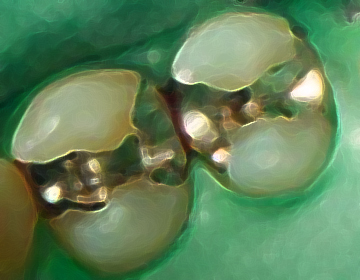 治療部位を分離