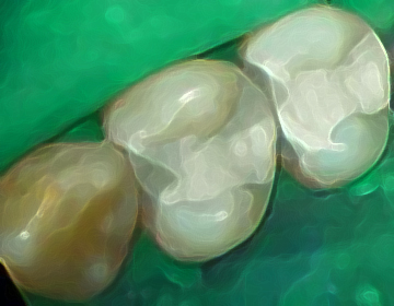 バランスをチェック