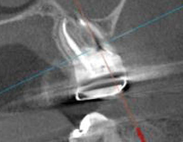 バランスをチェック